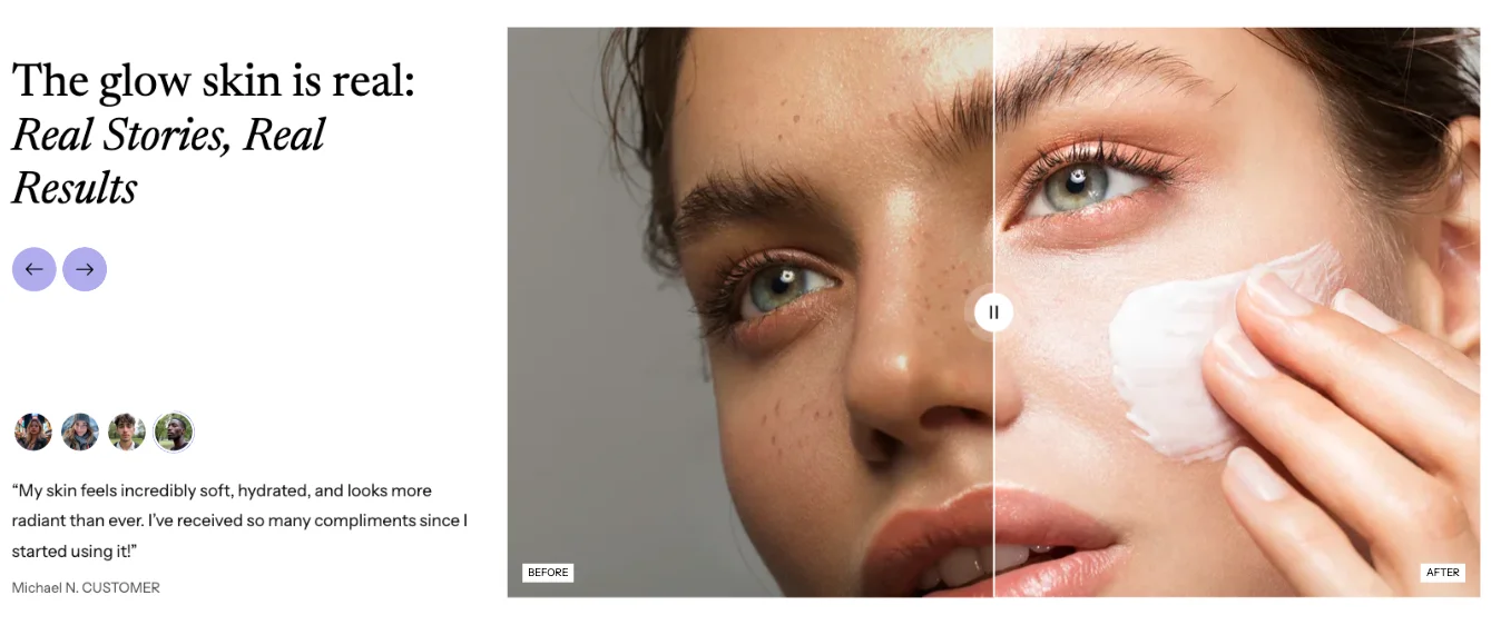 Before after testimonial